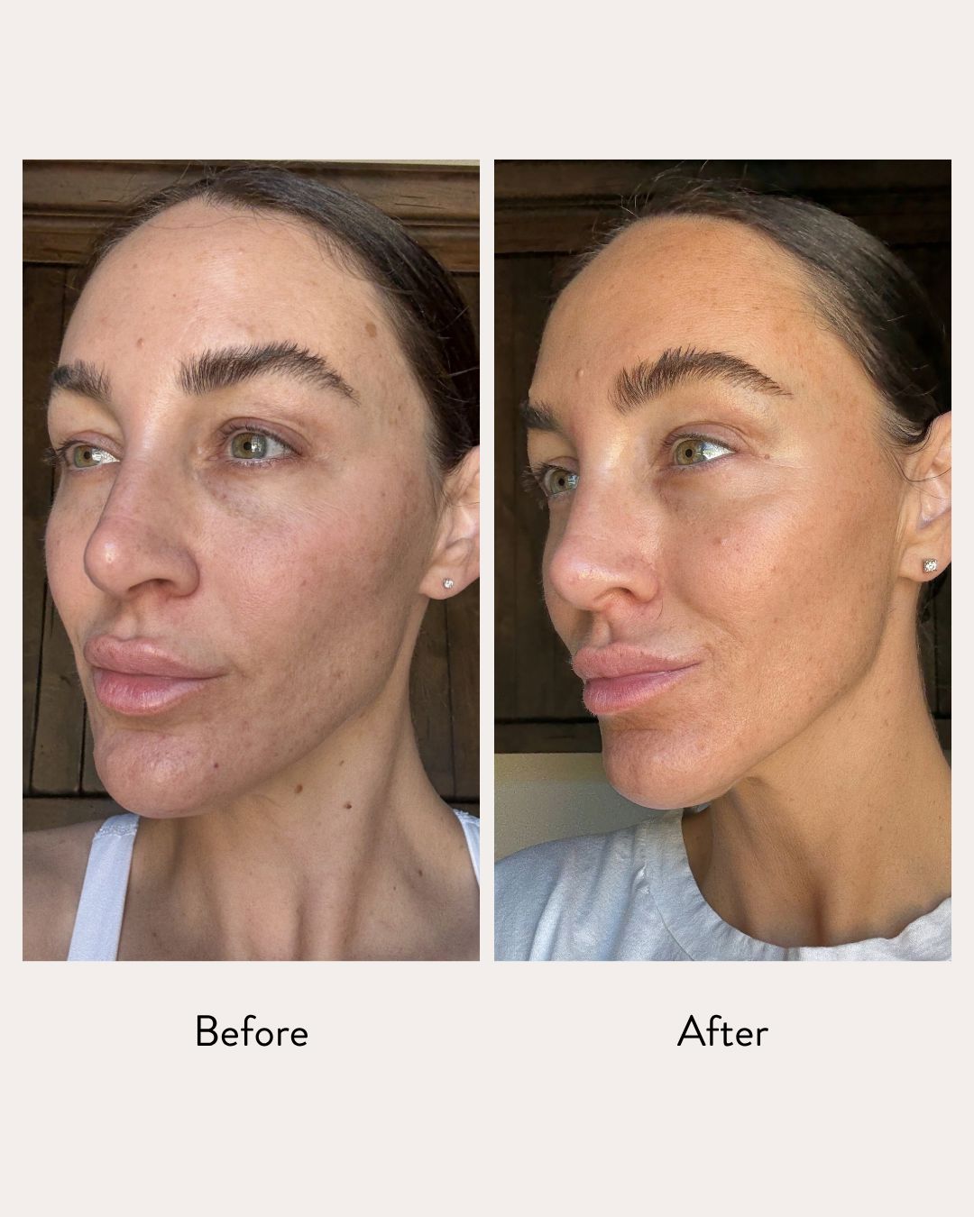 Tri-Peptide Therapy Serum Emme Diane 