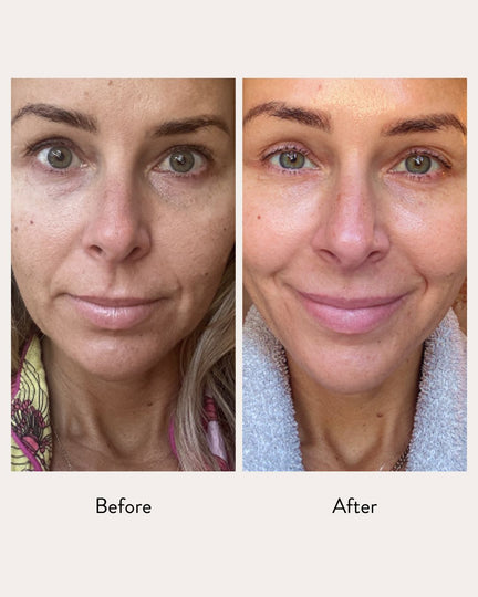 Tri-Peptide Therapy Serum Emme Diane 