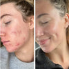 Clear Skincare Set Skincare Set Emme Diane 