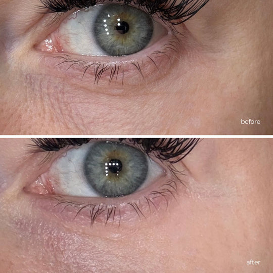Lifting Eye Serum Eye Treatment Emme Diane 