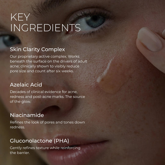 Harmonize Acne Treatment Emme Diane 