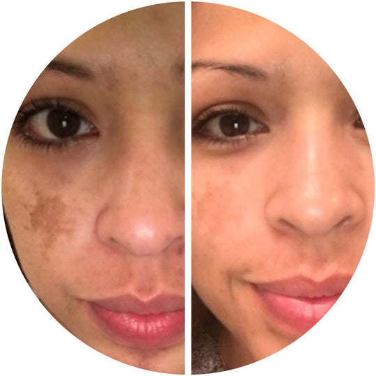 Lighten Up Skin Care Set Skincare Set Emme Diane 